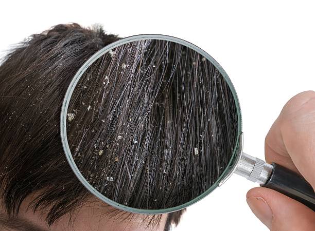 SCALP AND HAIR THERAPY